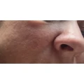 BillmaMED dermatologie - Hautarztpraxis Dr. med. Claudia Billmann Fach&auml;rztin f&uuml;r Dermatologie Wegberg