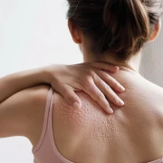 BillmaMED dermatologie - Hautarztpraxis Dr. med. Claudia Billmann Linnich