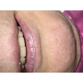 Buhl Dentaltechnik Schildow