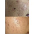 De Luna Laser&Kosmetik Essen