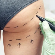 Dr.med.Dr.med.dent. Wolfgang Schmitt Facharzt für MKG-Chirurgie Düsseldorf