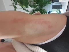 Das sind die Rote Punkte