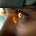 Dr.med. Gisela Kroher Fach&auml;rztin f&uuml;r Augenheilkunde Schotten