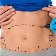 Dr.med. J&uuml;rgen Schaff Facharzt f&uuml;r Plastische- und &Auml;sthetische Chirurgie M&uuml;nchen