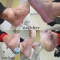 Fu&szlig;pflege Backnang Yvonne Kernstock Backnang