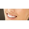 Logo Lisin, Natalie