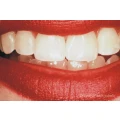 Zahn&auml;sthetik J&uuml;rgen Jakob Dentallabor Dentallabor Griesheim